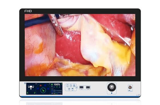 Goede prijs Noise Reduction Videoscope Inspection Camera Full HD ENT Procedures Dual Lens Inspection online