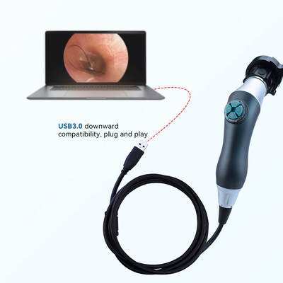 Bon prix Endoscope portatif USB avec capteur CMOS SONY à résolution 1080P et conception portative ergonomique pour l'examen médical ORL en ligne