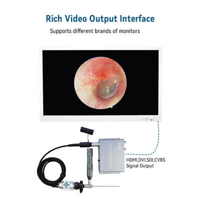 Goede prijs Medische draagbare endoscopie mand beeldprocessor RGB kleur synchronisatie USB 2.0 endoscoop camera online