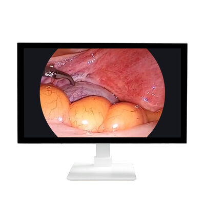 Goede prijs Chirurgie LG-scherm medisch kwaliteitsmonitor Helder medisch display-monitoren online