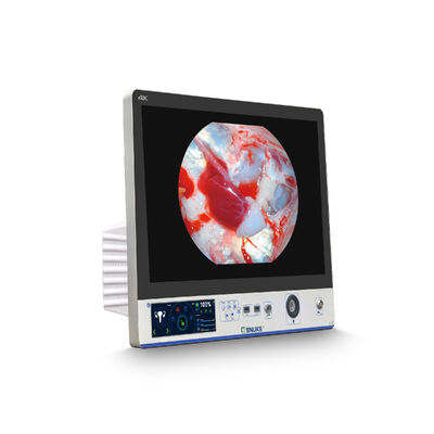 Guter Preis Dual-Axis All-in-One Endoskopkamera 27in Bildschirm Klinische Boreskopkamera Online