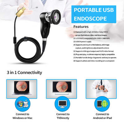 Bon prix Caméra endoscopique portable Full HD 1080P 60FPS avec capteur CMOS SONY et caméra endoscopique USB H.264 à faible bande passante en ligne