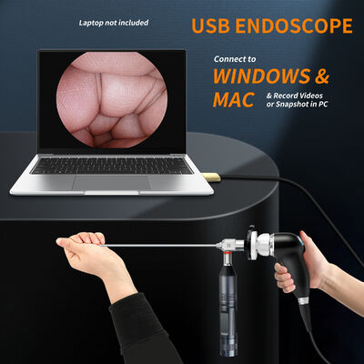 Bon prix LN-S354 La caméra endoscopique qui fonctionne sur un ordinateur portable. Pas de chariot. Pas de moniteur. Pas de cordon d'alimentation. en ligne